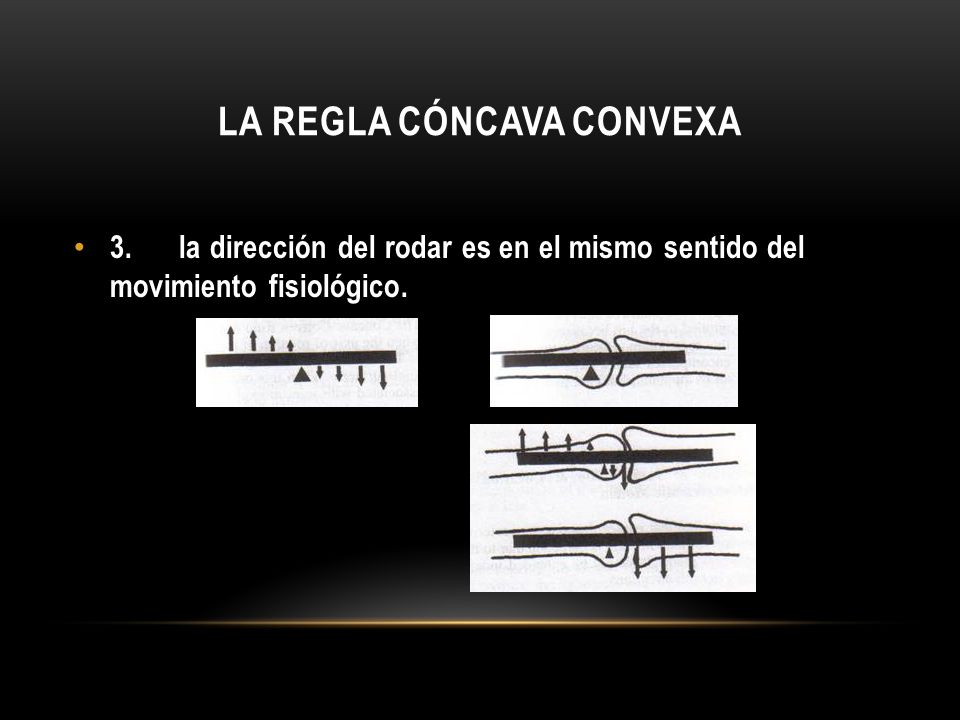 REGLA CONCAVO CONVEXA DOWNLOAD REGLA CONCAVO CONVEXA DOWNLOAD